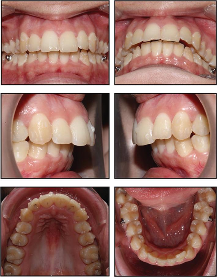 https://cdn.ncbi.nlm.nih.gov/pmc/blobs/312f/9860201/42e021bc1842/CCR3-11-e6854-g008.jpg