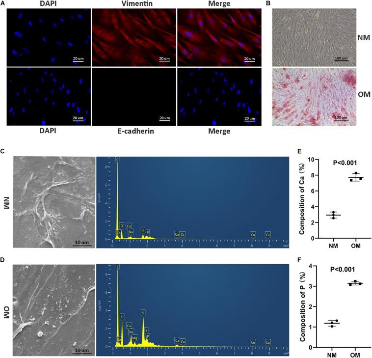 https://cdn.ncbi.nlm.nih.gov/pmc/blobs/3134/7829506/54238a6e2f77/fcell-08-596363-g002.jpg