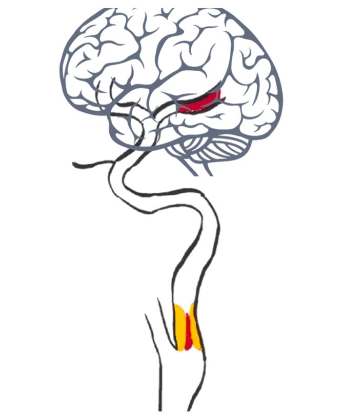 https://cdn.ncbi.nlm.nih.gov/pmc/blobs/3136/10792755/79fda1bc48a8/gr1.jpg