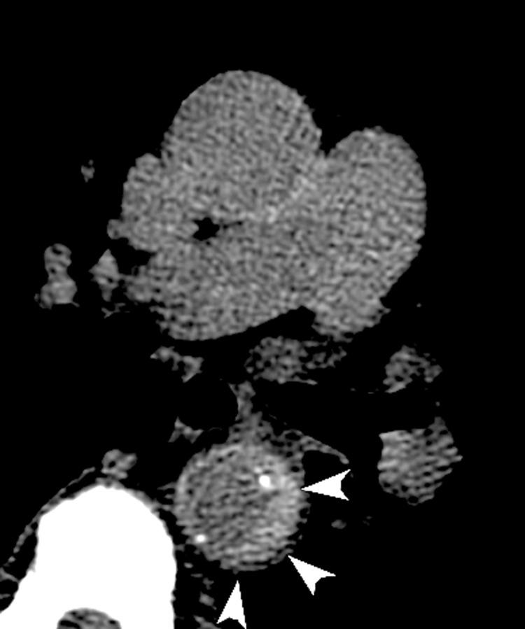 https://cdn.ncbi.nlm.nih.gov/pmc/blobs/313a/4985448/6124b36f5665/bjr.20150705.g003.jpg