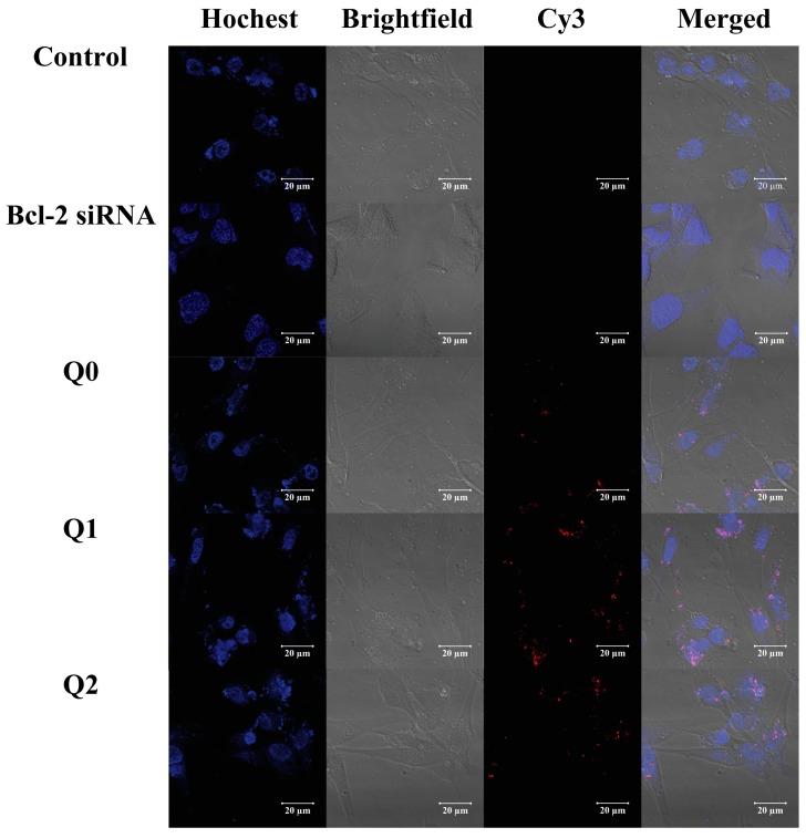 https://cdn.ncbi.nlm.nih.gov/pmc/blobs/313b/5869622/0d96c5e03812/nanomaterials-08-00131-g006.jpg