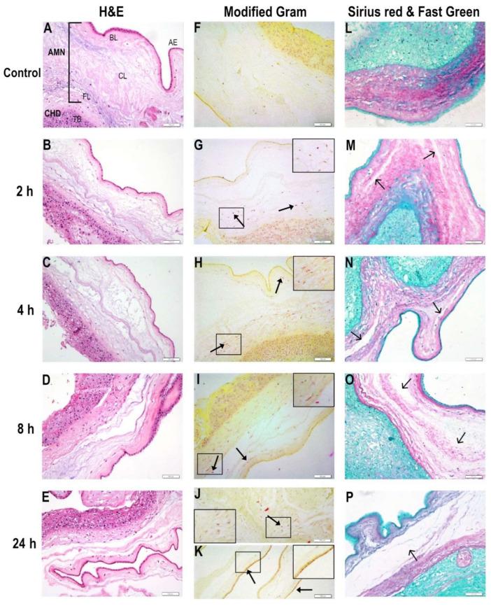 https://cdn.ncbi.nlm.nih.gov/pmc/blobs/3143/8949057/075b371d9fb9/ijms-23-02994-g001.jpg