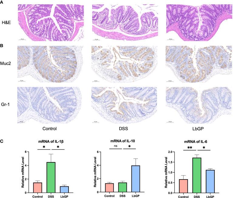https://cdn.ncbi.nlm.nih.gov/pmc/blobs/3143/9395742/767d1db95851/fcimb-12-921075-g002.jpg
