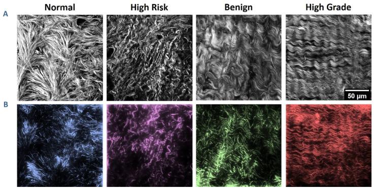 https://cdn.ncbi.nlm.nih.gov/pmc/blobs/314b/11048585/ff046c60b56c/cancers-16-01560-g004.jpg