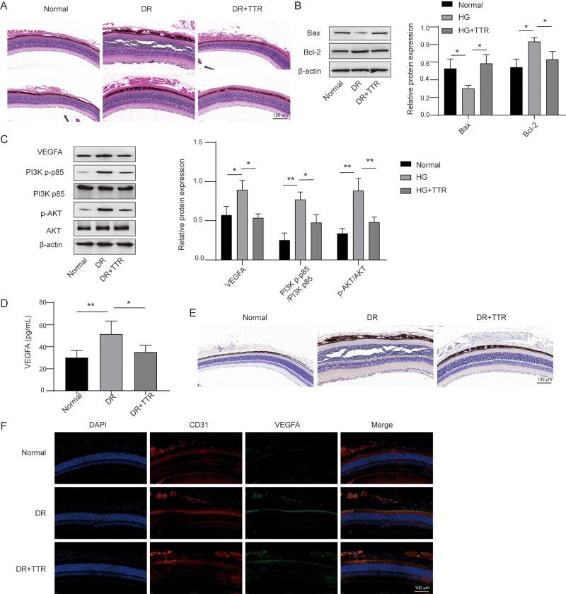 https://cdn.ncbi.nlm.nih.gov/pmc/blobs/3168/10833055/13c58b949d1e/iovs-65-1-45-f004.jpg