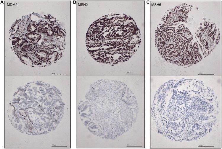 https://cdn.ncbi.nlm.nih.gov/pmc/blobs/316b/8334731/1eed171fef0c/fgene-12-568779-g006.jpg
