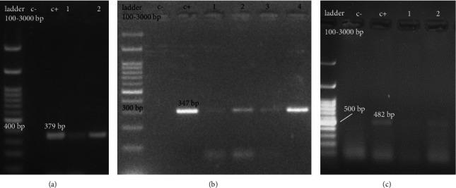 https://cdn.ncbi.nlm.nih.gov/pmc/blobs/316f/10824580/b71a96261ee8/AV2024-7613948.002.jpg