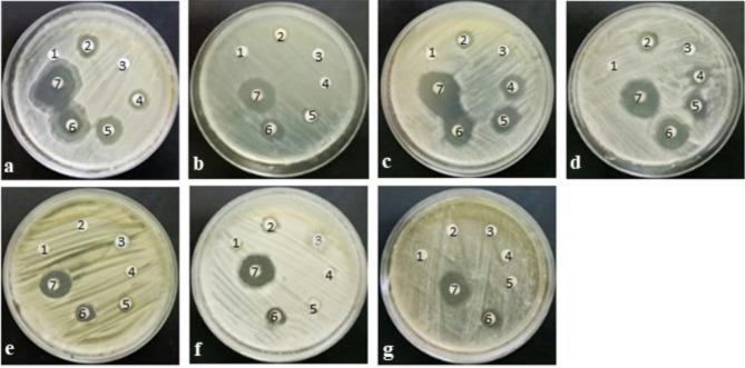 https://cdn.ncbi.nlm.nih.gov/pmc/blobs/316f/12012204/6a980a95a4bd/41598_2025_95899_Fig7_HTML.jpg