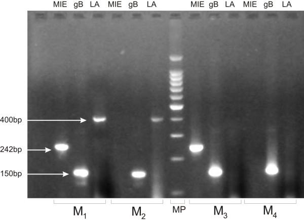 https://cdn.ncbi.nlm.nih.gov/pmc/blobs/317f/449715/5d9abe626c1f/1471-2431-4-11-1.jpg