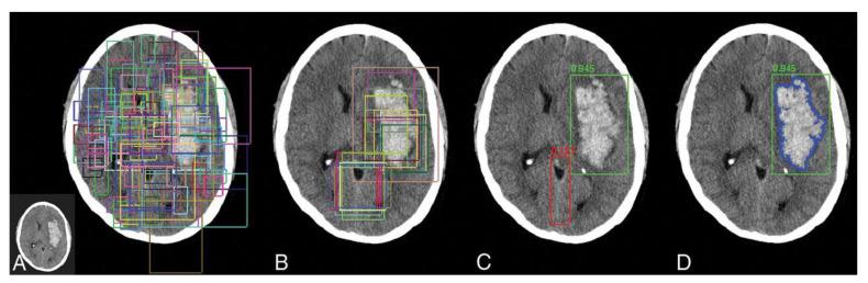 https://cdn.ncbi.nlm.nih.gov/pmc/blobs/3180/9600234/4597de06f182/diagnostics-12-02535-g008.jpg