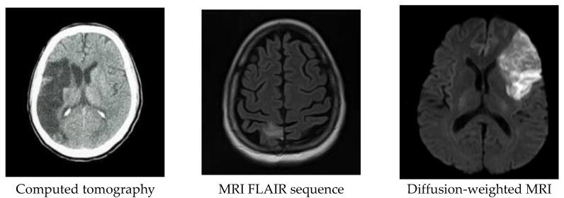 https://cdn.ncbi.nlm.nih.gov/pmc/blobs/3180/9600234/5665e81d9730/diagnostics-12-02535-g001.jpg