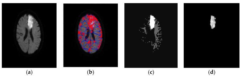 https://cdn.ncbi.nlm.nih.gov/pmc/blobs/3180/9600234/659bca4ad782/diagnostics-12-02535-g007.jpg