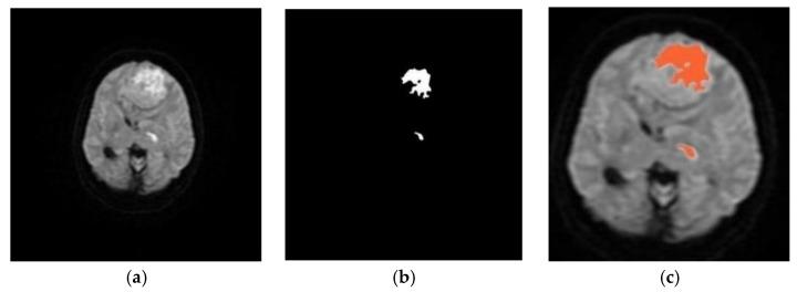 https://cdn.ncbi.nlm.nih.gov/pmc/blobs/3180/9600234/9836af050f1b/diagnostics-12-02535-g004.jpg