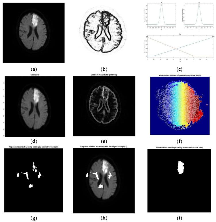 https://cdn.ncbi.nlm.nih.gov/pmc/blobs/3180/9600234/b4ae8d2f097c/diagnostics-12-02535-g005.jpg