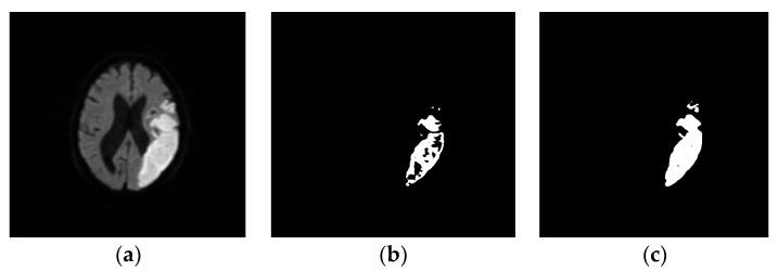 https://cdn.ncbi.nlm.nih.gov/pmc/blobs/3180/9600234/f8072c902987/diagnostics-12-02535-g006.jpg