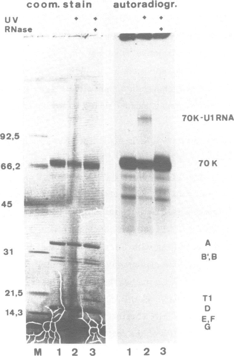 https://cdn.ncbi.nlm.nih.gov/pmc/blobs/318b/338992/99477349b90f/nar00165-0061-a.jpg