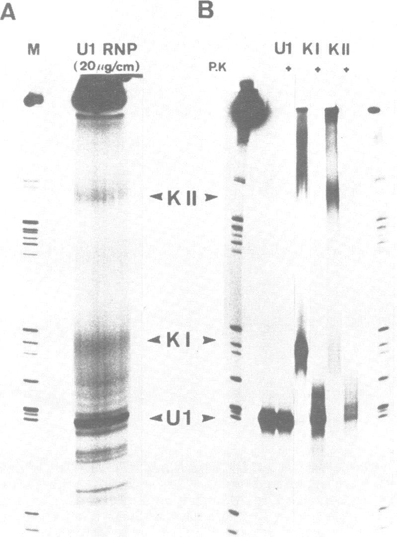 https://cdn.ncbi.nlm.nih.gov/pmc/blobs/318b/338992/b5e61166c19c/nar00165-0051-a.jpg