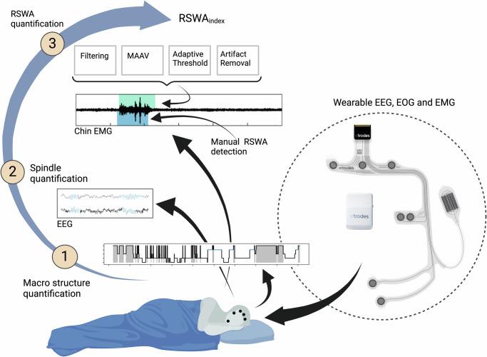 https://cdn.ncbi.nlm.nih.gov/pmc/blobs/318e/11605064/53d22406b96e/41746_2024_1354_Fig1_HTML.jpg