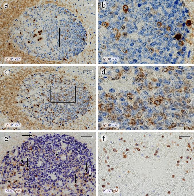 https://cdn.ncbi.nlm.nih.gov/pmc/blobs/3194/7343761/0b5d6894475b/418_2020_1861_Fig7_HTML.jpg