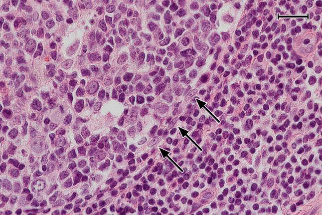 https://cdn.ncbi.nlm.nih.gov/pmc/blobs/3194/7343761/11c57113dccc/418_2020_1861_Fig10_HTML.jpg