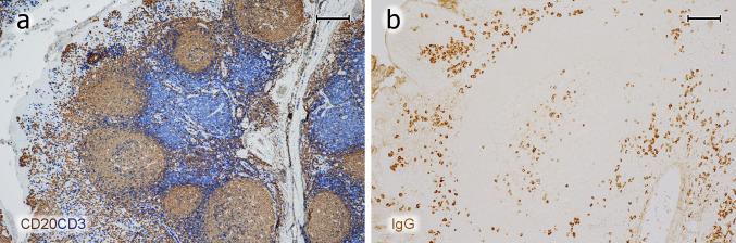 https://cdn.ncbi.nlm.nih.gov/pmc/blobs/3194/7343761/2259b389d6b2/418_2020_1861_Fig1_HTML.jpg
