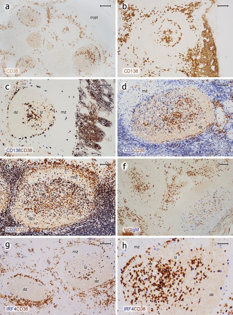 https://cdn.ncbi.nlm.nih.gov/pmc/blobs/3194/7343761/473d033eafcb/418_2020_1861_Fig4_HTML.jpg