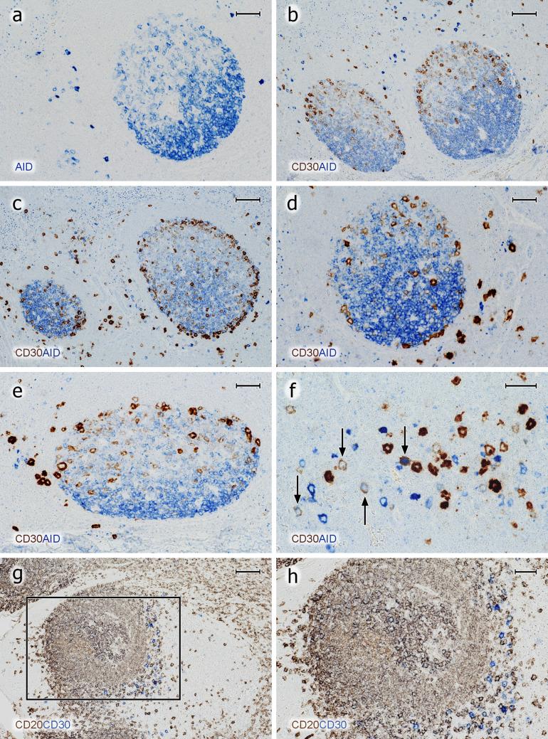 https://cdn.ncbi.nlm.nih.gov/pmc/blobs/3194/7343761/6ed4eb72a4a4/418_2020_1861_Fig9_HTML.jpg