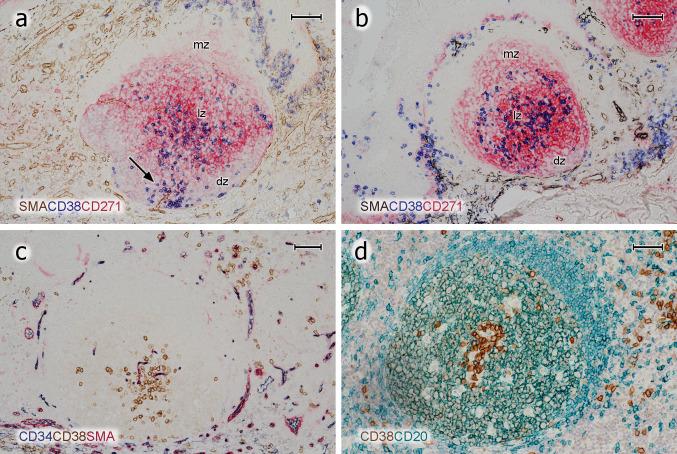 https://cdn.ncbi.nlm.nih.gov/pmc/blobs/3194/7343761/78cc3d4a340c/418_2020_1861_Fig5_HTML.jpg