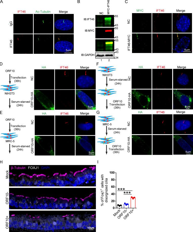 https://cdn.ncbi.nlm.nih.gov/pmc/blobs/3195/9184850/0cce29342638/JCB_202108015_FigS5.jpg