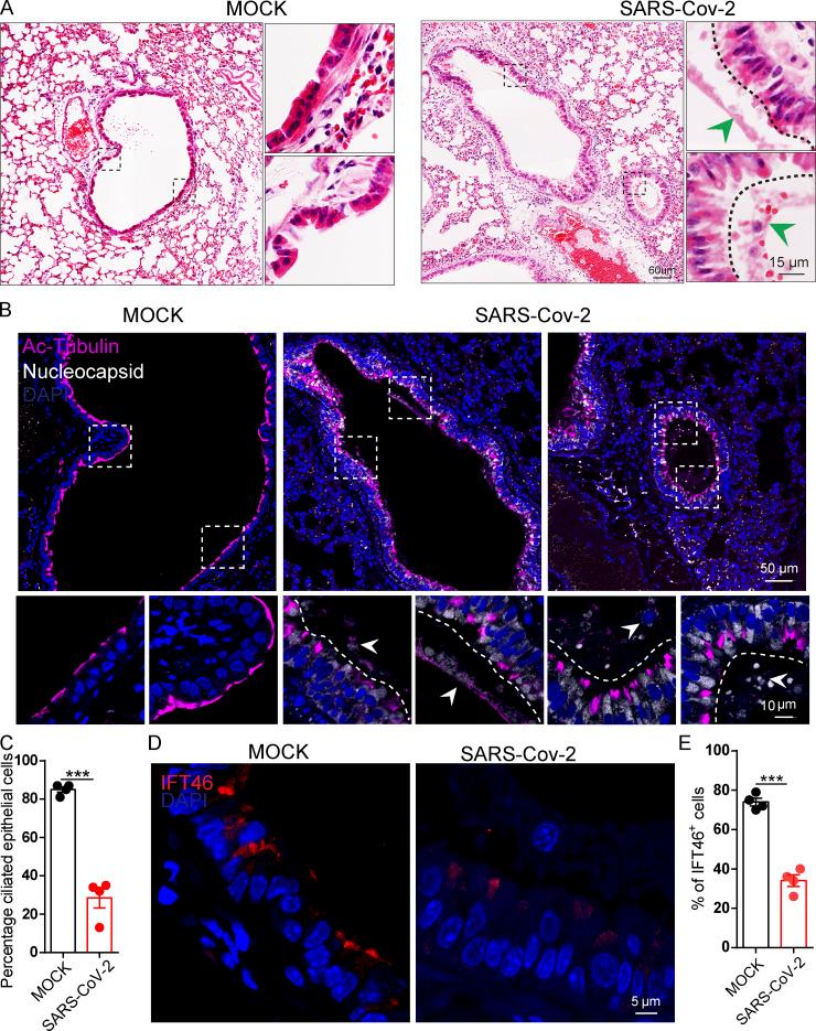 https://cdn.ncbi.nlm.nih.gov/pmc/blobs/3195/9184850/5b2d6f400c11/JCB_202108015_Fig8.jpg
