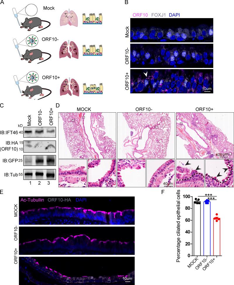 https://cdn.ncbi.nlm.nih.gov/pmc/blobs/3195/9184850/eb325fb6c92a/JCB_202108015_Fig7.jpg