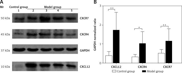 https://cdn.ncbi.nlm.nih.gov/pmc/blobs/3199/10507761/69b1c227c08f/AMS-19-5-170910-g004.jpg
