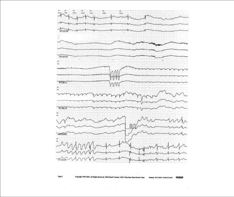 https://cdn.ncbi.nlm.nih.gov/pmc/blobs/319b/5210461/2efd0210d28c/abc-107-06-0568-g01.jpg