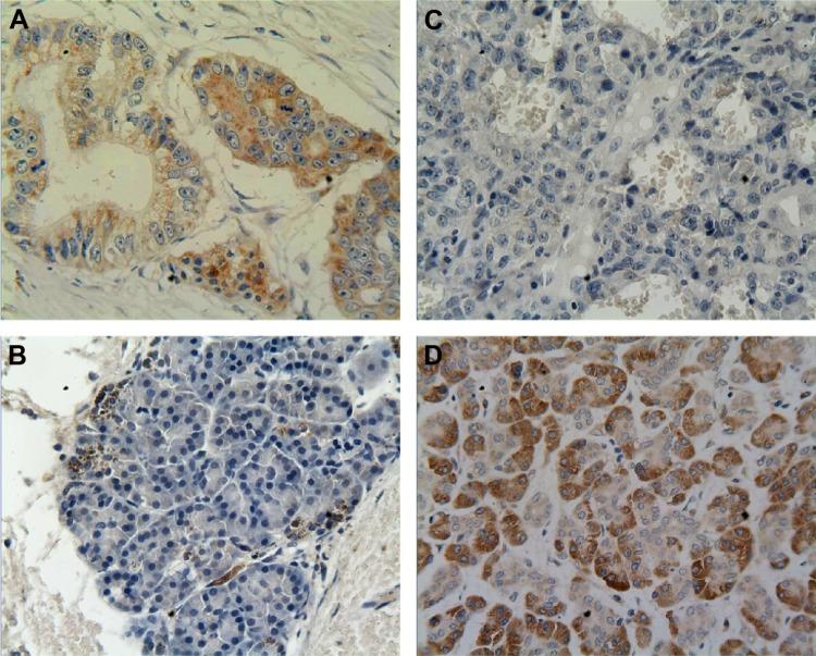 https://cdn.ncbi.nlm.nih.gov/pmc/blobs/31a2/4694694/5844fe926134/tcrm-12-011Fig1.jpg