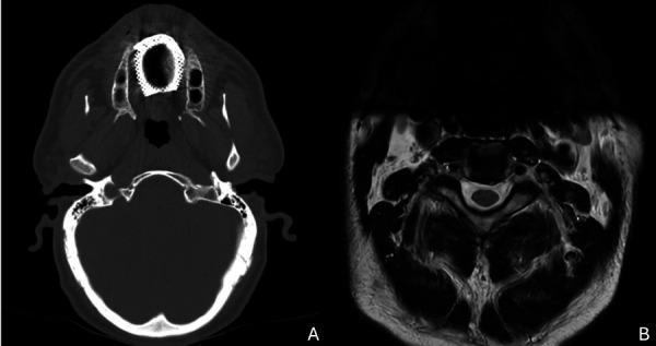 https://cdn.ncbi.nlm.nih.gov/pmc/blobs/31a4/12126162/1c5892f3d607/eor-059-058-e002.jpg