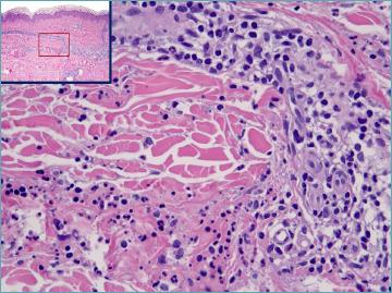 https://cdn.ncbi.nlm.nih.gov/pmc/blobs/31a5/11138767/0311fc97b7ae/pathol-2024-02-119-g001.jpg