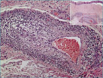 https://cdn.ncbi.nlm.nih.gov/pmc/blobs/31a5/11138767/5ed3100dd35a/pathol-2024-02-119-g011.jpg