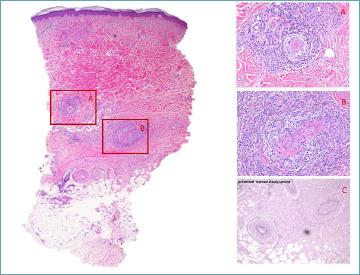 https://cdn.ncbi.nlm.nih.gov/pmc/blobs/31a5/11138767/946ee044e69f/pathol-2024-02-119-g009.jpg