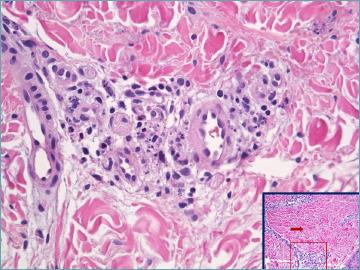 https://cdn.ncbi.nlm.nih.gov/pmc/blobs/31a5/11138767/ab0f4f57d5f3/pathol-2024-02-119-g002.jpg