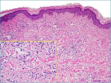 https://cdn.ncbi.nlm.nih.gov/pmc/blobs/31a5/11138767/c4dd79e5fb97/pathol-2024-02-119-g004.jpg