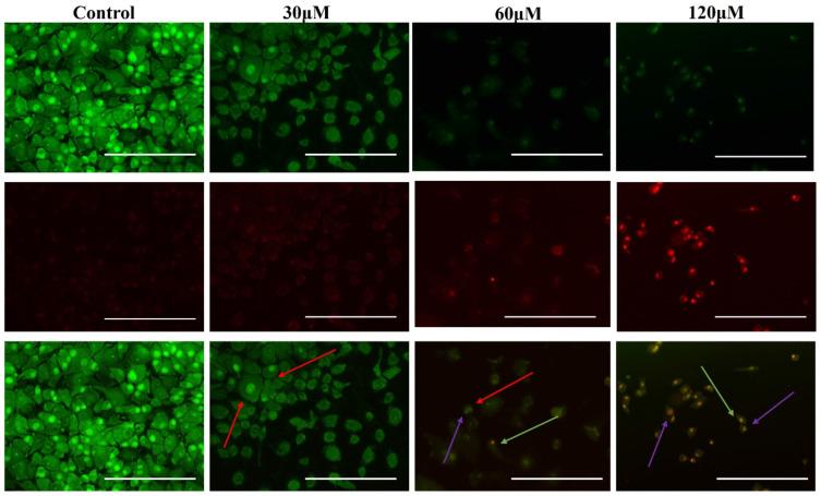 https://cdn.ncbi.nlm.nih.gov/pmc/blobs/31ae/12228500/0becb166e4c4/JIR-18-8657-g0007.jpg