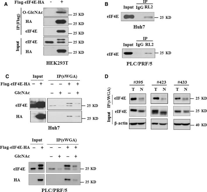 https://cdn.ncbi.nlm.nih.gov/pmc/blobs/31af/6433694/622949e5ba58/JCMM-23-2384-g003.jpg