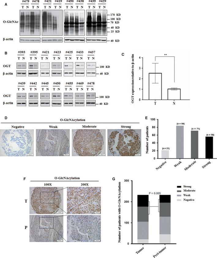https://cdn.ncbi.nlm.nih.gov/pmc/blobs/31af/6433694/a5c392789900/JCMM-23-2384-g001.jpg