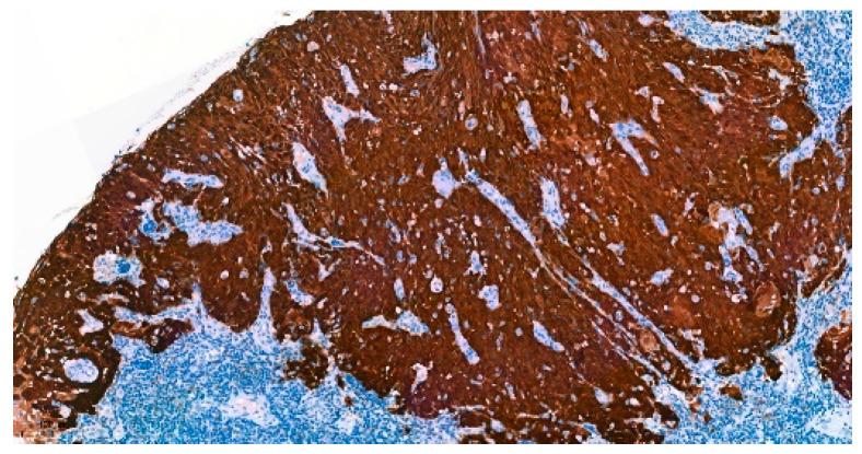 https://cdn.ncbi.nlm.nih.gov/pmc/blobs/31b0/9954851/94474c4f99df/curroncol-30-00111-g001.jpg