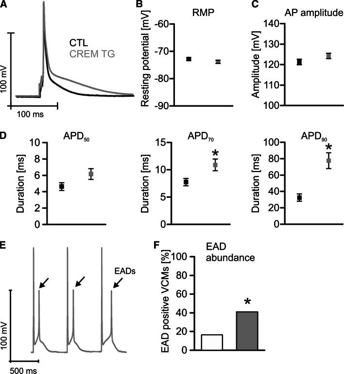 https://cdn.ncbi.nlm.nih.gov/pmc/blobs/31b7/4729809/20412ac78ab6/395_2016_532_Fig5_HTML.jpg