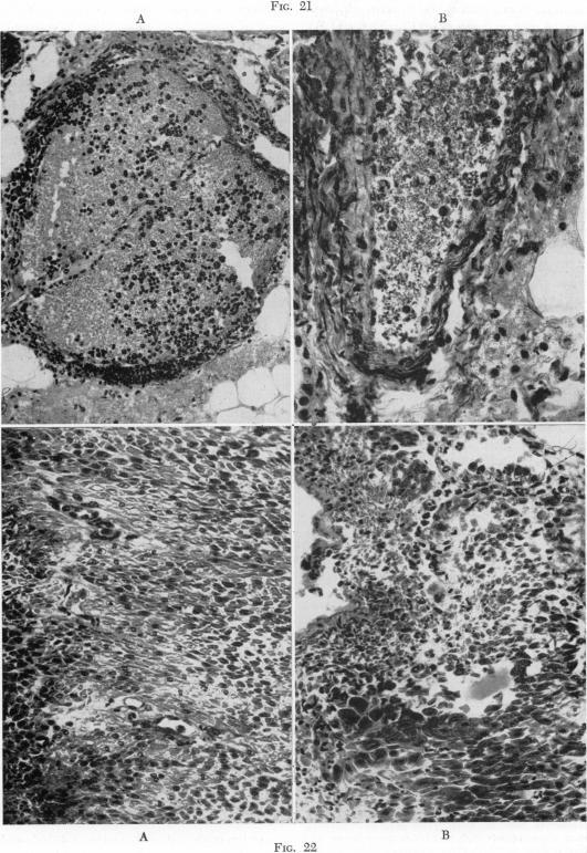 https://cdn.ncbi.nlm.nih.gov/pmc/blobs/31bd/1802341/05c4ac45c6a4/annsurg01426-0076-a.jpg