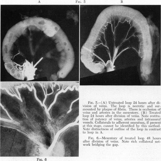 https://cdn.ncbi.nlm.nih.gov/pmc/blobs/31bd/1802341/5341570f7cdb/annsurg01426-0064-a.jpg