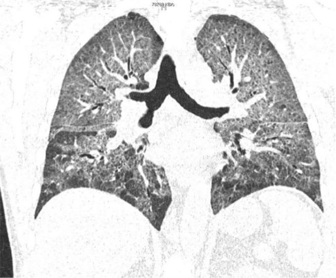 https://cdn.ncbi.nlm.nih.gov/pmc/blobs/31be/5063753/a784025ea8da/ccrep-9-2016-091f1.jpg