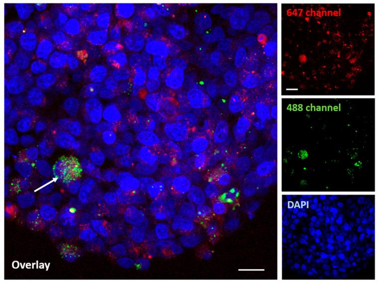 https://cdn.ncbi.nlm.nih.gov/pmc/blobs/31c0/11173746/26aa32bbdfa8/molecules-29-02469-g010.jpg