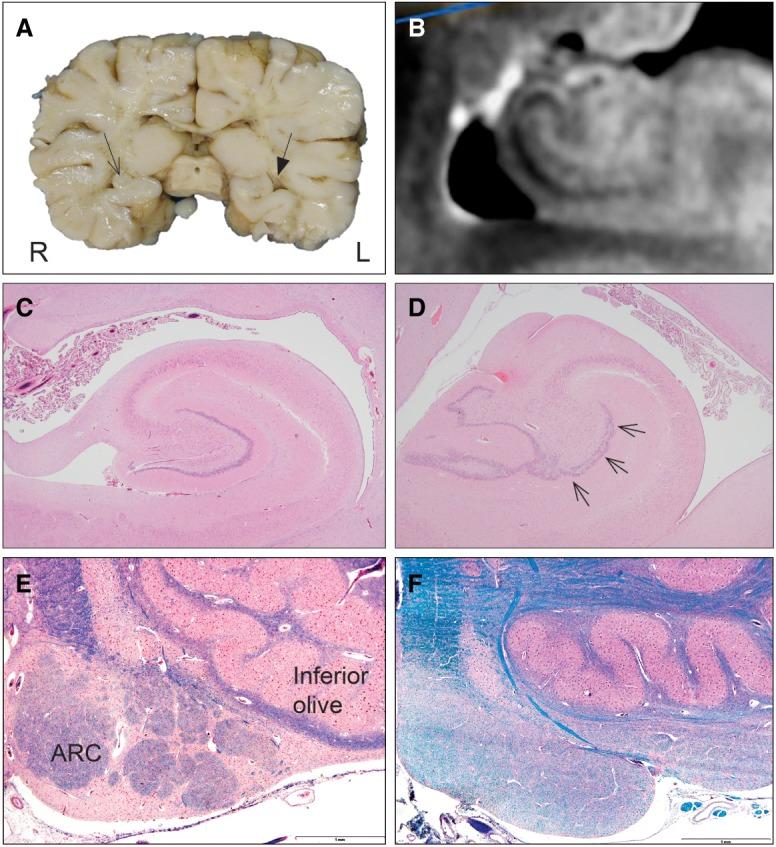 https://cdn.ncbi.nlm.nih.gov/pmc/blobs/31c0/6371743/3a8f2bf92c82/MCS003442Roc_F2.jpg